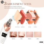 5-in-1 Blackhead Remover™ | Vacuüm mee-eter verwijderaar